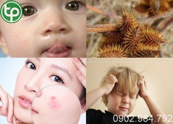 Công Dụng Chữa Bệnh Của Ké đầu ngựa